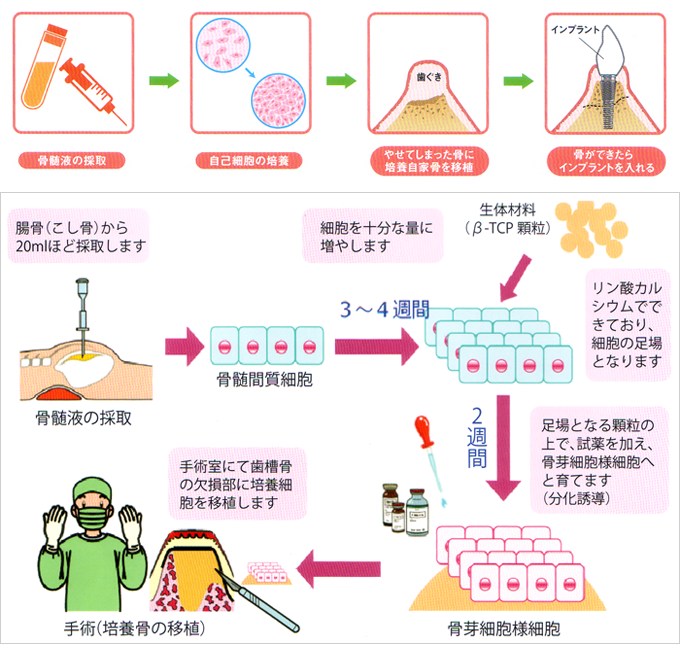 TE-BONEの治療の流れ